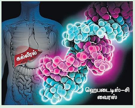 ‘ஹெபடைடிஸ்-சி’ நோயாளிகள் கவனத்துக்கு...﻿