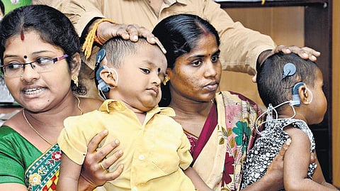 மதுரை அரசு மருத்துவர்களின் முயற்சியால்﻿ பிறவியிலேயே காதுகேளாத 2 குழந்தைகள் இயல்பான கேட்கும் திறன் பெற்றனர்﻿