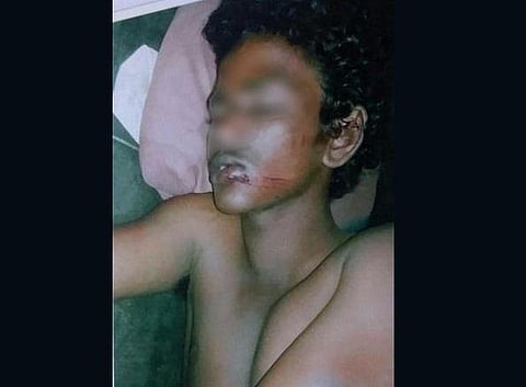 துரைப்பாக்கத்தில் ஆள்மாறாட்டத்தால் சிறுவனை கொடூரமாக தாக்கி நடுரோட்டில் வீசிய போலீஸார்: நடவடிக்கை கோரி ஆணையரிடம் மனு