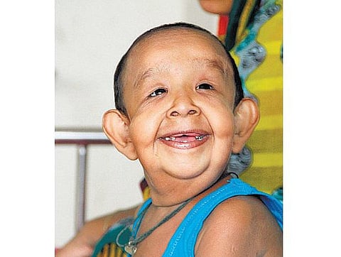 வங்கதேசத்தில் 4 வயது சிறுவனுக்கு முதுமை﻿