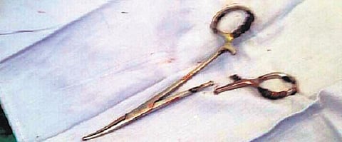 வயிற்றில் கத்தரிக்கோலுடன் 18 ஆண்டுகள் வாழ்ந்த மனிதர்: டாக்டர்களின் மறதியால் விபரீதம்﻿