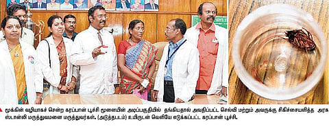 தூங்கிக்கொண்டிருந்த பெண்ணின்﻿ மூக்கில் புகுந்து மூளை வரை சென்ற கரப்பான்பூச்சி﻿: ஸ்டான்லி மருத்துவர்கள் உயிருடன் அகற்றினர்﻿