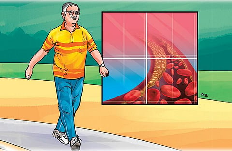 சந்தேகம் சரியா 38: நடைப்பயிற்சியால் நல்ல கொழுப்பு கூடுமா?﻿