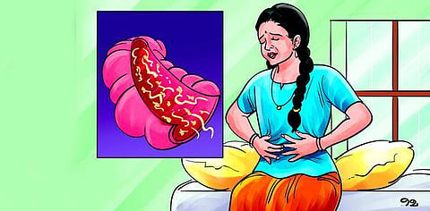 சந்தேகம் சரியா 44: பேதி மருந்து சாப்பிட்டால் குடல் புழுக்கள் ஒழியுமா?