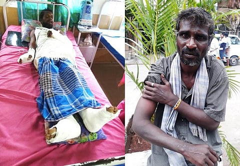 கடற்கரையில் உறங்கிய மீனவர்கள் மீது கடும் தாக்கு: கை, கால் உடைந்து மருத்துவமனையில் அனுமதி