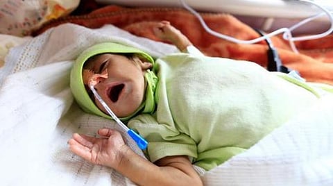 உலகிலேயே ஏழை நாடாக ஏமன் நாடு மாறும்: போரின் விளைவுகள் குறித்து ஐநா எச்சரிக்கை