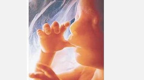 கருக்கலைப்பு மசோதா வரவேற்புக்குரியது ﻿