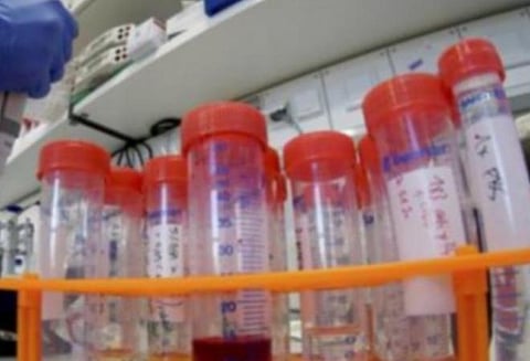 பாகிஸ்தானில் பரவிய கரோனா தொற்றில் 79% சமூகப் பரவல்