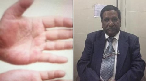 கரோனா காலத்தில் சரும நோய்கள் : எளிதான  தீர்வு
