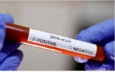 கரோனா உயிரிழப்பு; இந்தியாவில் 2.82 சதவீதம் மட்டுமே: மத்திய அரசு அறிவிப்பு
