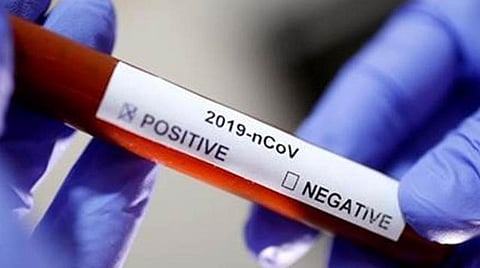 மதுரையில் கரோனா பரிசோதனை முடிவை அறிவிக்க 4 நாட்கள் ஆவதால் மன அழுத்தத்தில் நோயாளிகள் தவிப்பு 