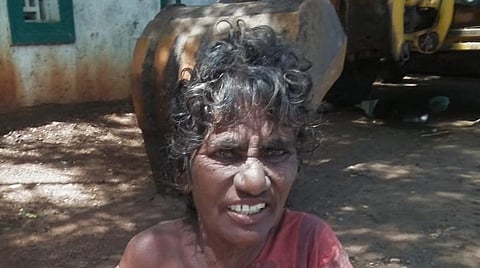 ஆதரவற்ற நிலையில் உள்ள மூதாட்டி.
