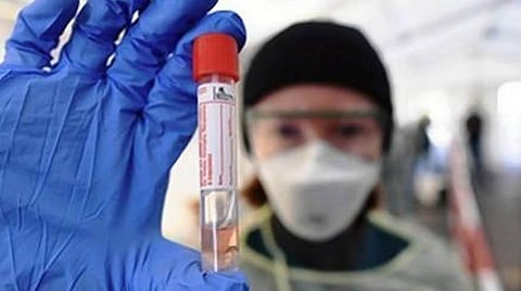 இந்தியாவில் 2 கோடிக்கு மேற்பட்டோருக்கு கோவிட்-19 சோதனை