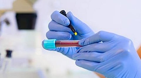 பிரதிநிதித்துவப் படம்