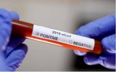 இந்தியாவில்  கரோனா இறப்பு விகிதம்; 1.76 சதவீதமாக குறைந்தது