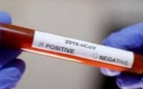 இந்தியாவில் கரோனா பாதிப்பு மூன்று லட்சத்திற்கும் கீழ் குறைவு