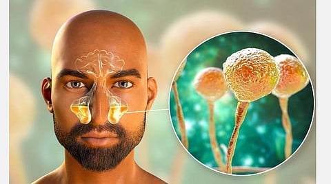 கருப்புப் பூஞ்சை நோயை வரும்முன் காப்பதே நன்று: டாக்டர் சிவப்பிரகாஷ்