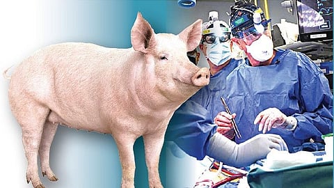 பன்றியின் இதயம் மனிதருக்குப் பொருந்தியது எப்படி?