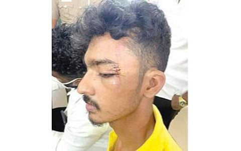 சட்டக் கல்லூரி மாணவரை தாக்கிய விவகாரம்; கொடுங்கையூர் காவலர்கள் இருவர் பணியிடை நீக்கம்: பேஸ்புக்கில் சர்ச்சை கருத்து பதிவிட்ட பூக்கடை எஸ்ஐ சஸ்பெண்ட்