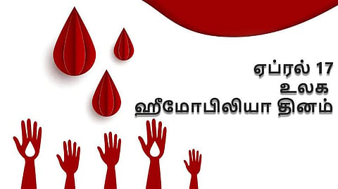ஹீமோபிலியா: உறைய மறுக்கும் ரத்தம், தவிர்க்கும் வழிகள், சிகிச்சை முறைகள்