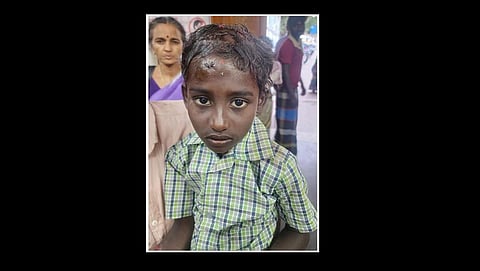 காயமடைந்த மாணவர்