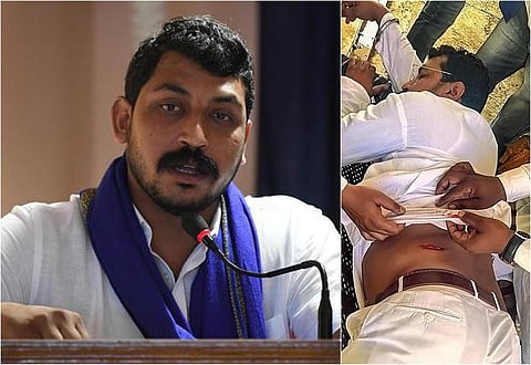 உ.பி. | 'பீம் ஆர்மி' சந்திரசேகர் ஆசாத் மீது துப்பாக்கிச் சூடு - நூலிழையில் உயிர் தப்பினார்