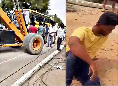 மதுரை விளையாட்டு வீரரின் கணுக்கால் அகற்றம் - மின் ஊழியர்களின் அலட்சியத்தால் நேர்ந்த துயரம்