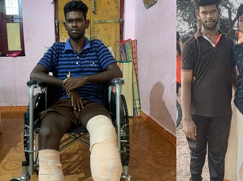 முழங்காலுக்கு கீழே கால்கள் துண்டிக்கப்பட்ட நிலையில் பூபாலன், விபத்துக்கு முன் பூபாலன்