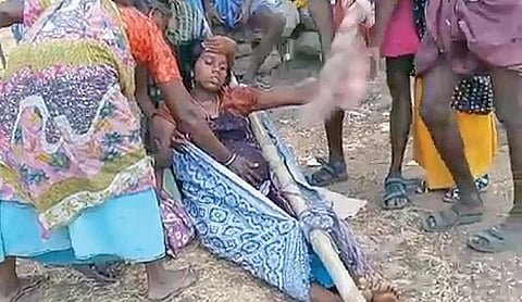 உடுமலை அருகே குழிப்பட்டி மலைவாழ் கிராமத்தில் பிரசவ வலியால் துடித்த கர்ப்பிணியை தொட்டில் கட்டி தூக்கிச்செல்ல தயாரான உறவினர்கள்.