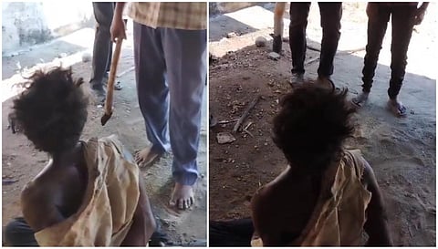 மனநலம் பாதித்த இளைஞரை தாக்கிய விஏஓ, திமுக வார்டு செயலாளர் மீது வழக்குப் பதிவு @ மேட்டூர்