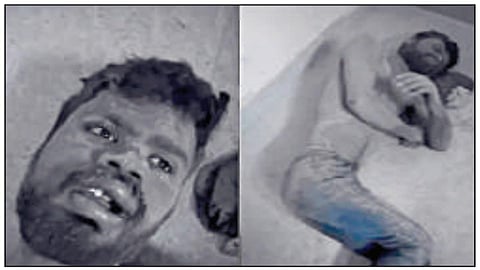 உயிருடன் புதைக்கப்பட்டேன்; தெரு நாய்கள் காப்பாற்றின - இளைஞர் புகார் மீது விசாரணை