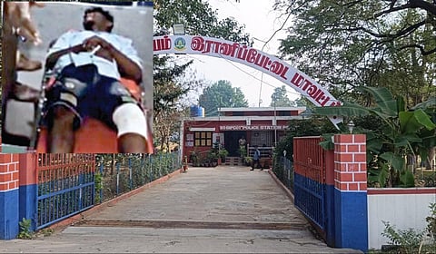 ராணிப்பேட்டை காவல் நிலையத்தின் மீது பெட்ரோல் குண்டுகள் வீச்சு: தப்பமுயன்ற இளைஞர் சுட்டு பிடிப்பு - நடந்தது என்ன?