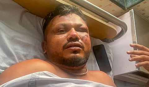 “எப்படி உயிர்ப் பிழைத்தேன் என தெரியவில்லை” - பயணி விஸ்வாஷ் குமார் ரமேஷ் அதிர்ச்சி
