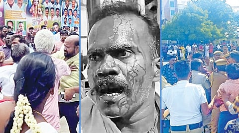 திண்டுக்கல் அருகே தாடிக்கொம்பில் மார்க்சிஸ்ட் கம்யூனிஸ்ட்-இந்து முன்னணியினரிடையே ஏற்பட்ட மோதல். (அடுத்த படம்) கைகலப்பில் மண்டை உடைந்து ரத்தம் வழிந்த நிலையில், பாஜக மாவட்டத் துணைத் தலைவர் பாலமுருகன்.(கடைசி படம்) திண்டுக்கல் அரசு மருத்துவக் கல்லூரி மருத்துவமனை முன்பு மோதிக் கொண்ட இருதரப்பினர்.