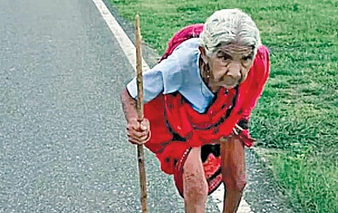 நாய் கடித்ததால் ரேபிஸ் தடுப்பூசி செலுத்துவதற்கு 20 கிலோ மீட்டர் தூரம் நடந்து சென்ற 95 வயது மூதாட்டி