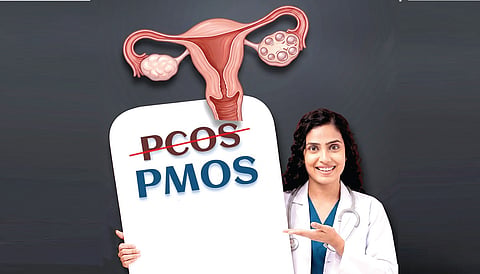 PCOS, PMOS நீர்க்கட்டிகளின் புதிய நிலை