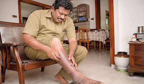 ஆறாத புண்கள்: அலட்சியம் வேண்டாம்!