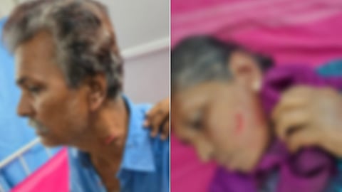 கிருஷ்ணகிரி அருகே வெறிநாய் கடித்து 7 பேர் காயம்