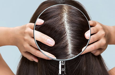 Does your anxiety affect your scalp health?
