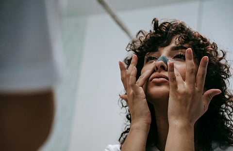 How to prevent blackheads with these basic skincare routines