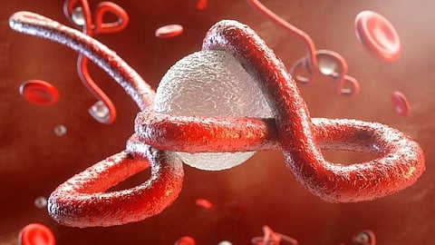 Ebola virus cases linked to ongoing outbreaks in Africa have pushed health authorities to increase screenings