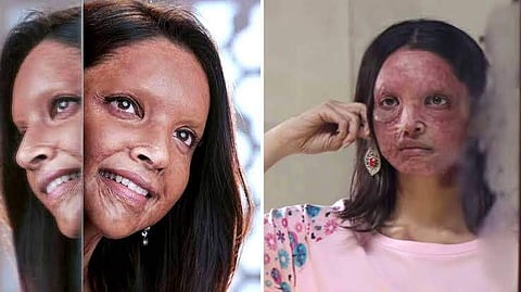 Deepika Padukone in Chhapaak