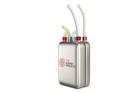 New artificial kidney-like device to free patients from dialysis