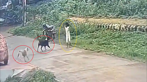little girl in Karnataka is attacked by street dogs