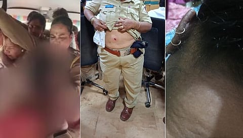  BJP Worker's 'Clothes Torn' Charge, Cops Claim 'She Stripped