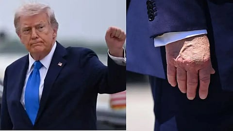 US president Trump 