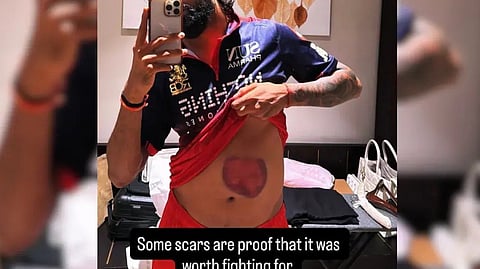 RCB all-rounder Krunal Pandya 