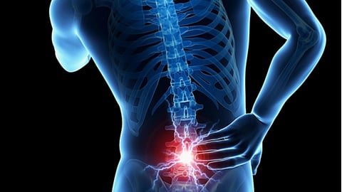 Coccydynia