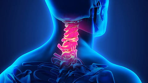 cervical dystonia
