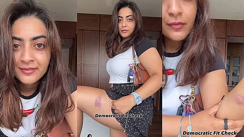 Acto Aamir Khan's niece Zayn Marie shows injury marks after detention at CJP protest